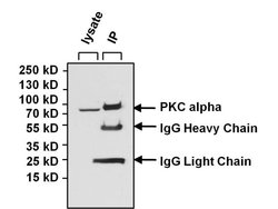 Invitrogen PKC alpha Monoclonal Antibody (MC5) 100 &mu;g; Unconjugated:Antibodies,