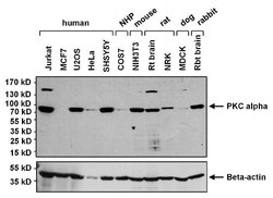 Invitrogen PKC alpha Monoclonal Antibody (MC5) 100 &mu;g; Unconjugated:Antibodies,