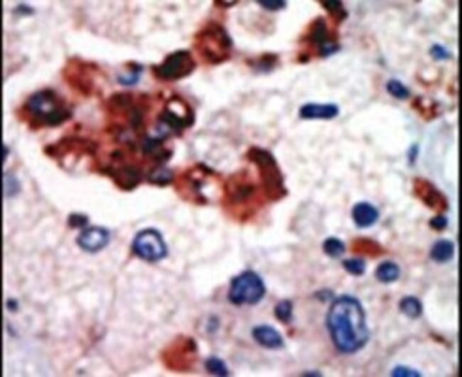 PKC lambda/iota Rabbit anti-Human, Polyclonal, Invitrogen 400 μL ...