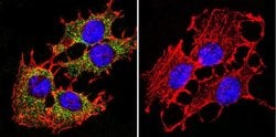 Invitrogen PMCA ATPase Monoclonal Antibody (5F10) 100 &mu;L; Unconjugated:Antibodies,