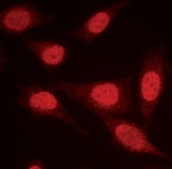 Invitrogen PPP2R1A Polyclonal Antibody 100 &mu;L; Unconjugated:Antibodies,