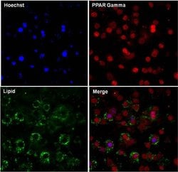 Invitrogen PPAR gamma Polyclonal Antibody 100 &mu;L; Unconjugated:Antibodies,