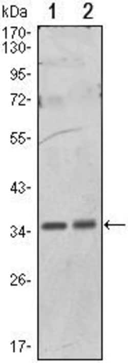 Invitrogen PP1 alpha Monoclonal Antibody (6D1) 100 &mu;L | Buy Online | Invitrogen&trade; | Fisher Scientific