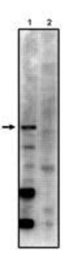 Invitrogen PPP2R5C Polyclonal Antibody 100 &mu;g; Unconjugated:Antibodies,