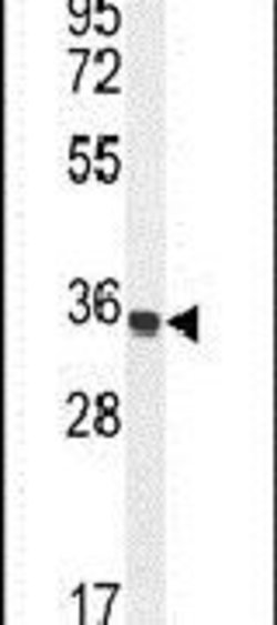 Trypsin Rabbit anti-Human, Polyclonal, Invitrogen 400 &mu;L; Unconjugated:Antibodies,