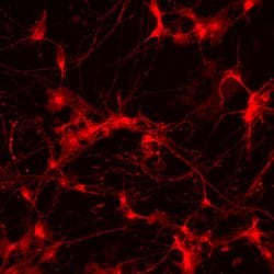 Invitrogen PSD-95 Recombinant Rabbit Monoclonal Antibody (23H23L19) 100