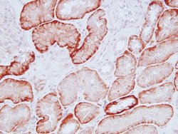 Invitrogen PTH1R Polyclonal Antibody 100 &mu;L; Unconjugated:Antibodies,