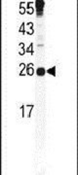 Securin Rabbit anti-Human, Polyclonal, Invitrogen 400 &mu;L; Unconjugated:Antibodies,