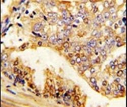 PUM2 Rabbit anti-Human, Polyclonal, Invitrogen 400 &mu;L; Unconjugated:Antibodies,