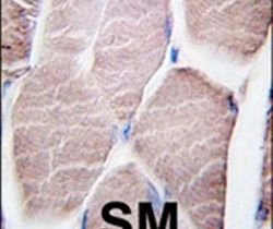 PYGM Rabbit anti-Human, Polyclonal, Invitrogen 400 &mu;L; Unconjugated:Antibodies,
