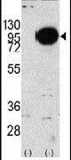 PYGM Rabbit anti-Human, Polyclonal, Invitrogen 400 &mu;L; Unconjugated:Antibodies,