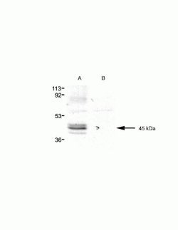 Invitrogen Pannexin 3 Polyclonal Antibody 100 &mu;g; Unconjugated:Antibodies,