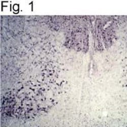 Parkin Polyclonal Antibody, Invitrogen&trade;