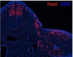 Invitrogen PAX3 Polyclonal Antibody 100 &mu;g; Unconjugated:Antibodies,