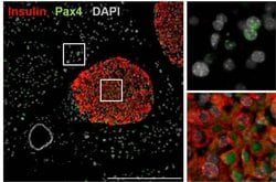 Invitrogen PAX4 Polyclonal Antibody 100 &mu;g; Unconjugated:Antibodies,