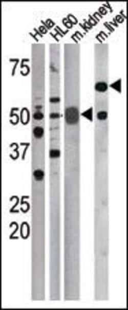 Phospho-Cdc25A (Ser75) Rabbit anti-Human, Mouse, Polyclonal, Invitrogen