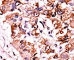 Phospho-CHK1 (Ser317), Polyclonal, Invitrogen 400&mu;L; Unconjugated:Antibodies,