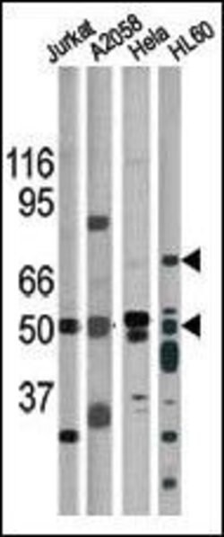 Phospho-CHK1 (Ser317), Polyclonal, Invitrogen 400&mu;L; Unconjugated:Antibodies,