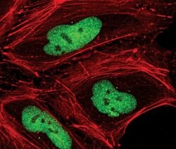 Invitrogen Phospho-CHK2 (Thr68) Polyclonal Antibody 100 &mu;L | Buy Online | Invitrogen&trade; | Fisher Scientific