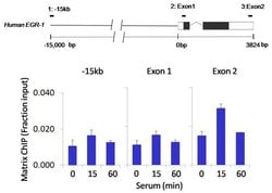 Invitrogen Phospho-PYK2 (Tyr402) Recombinant Rabbit Monoclonal Antibody (17H4L19) 100 &mu;g | Buy Online | Invitrogen&trade; | Fisher Scientific