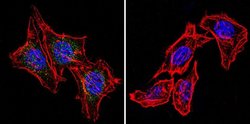 Invitrogen Phospho-Progesterone Receptor (Ser294) Monoclonal Antibody (608)