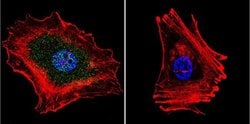 Invitrogen™ Phospho-Progesterone Receptor (Ser294) Monoclonal Antibody (608)