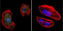 Invitrogen Phospho-Progesterone Receptor (Ser294) Monoclonal Antibody (608)