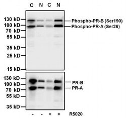 Invitrogen Phospho-Progesterone Receptor (Ser190) Monoclonal Antibody (1154)