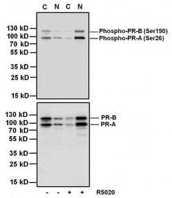 Invitrogen Phospho-Progesterone Receptor (Ser190) Monoclonal Antibody (1154)