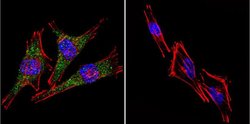 Invitrogen PSEN2 Monoclonal Antibody (APS 21) 200 &mu;g; Unconjugated:Antibodies,