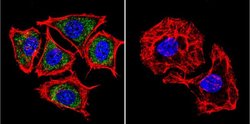 Invitrogen PSEN2 Monoclonal Antibody (APS 21) 200 &mu;g; Unconjugated:Antibodies,