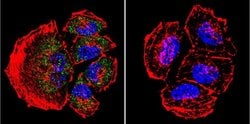 Invitrogen PSEN2 Monoclonal Antibody (APS 21) 200 &mu;g; Unconjugated:Antibodies,