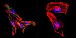 Invitrogen PSEN2 Monoclonal Antibody (APS 26) 200 &mu;g; Unconjugated:Antibodies,