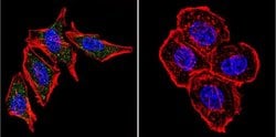 Invitrogen PSEN2 Monoclonal Antibody (APS 26) 200 &mu;g; Unconjugated:Antibodies,