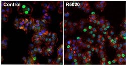 Invitrogen Progesterone Receptor Monoclonal Antibody (Alpha PR6) 100 &mu;g;