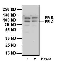 Invitrogen Progesterone Receptor Monoclonal Antibody (Alpha PR6) 100 &mu;g;