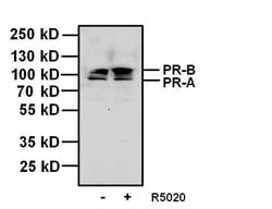 Invitrogen Progesterone Receptor Monoclonal Antibody (alpha PR-22) 100