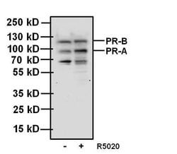 Invitrogen Progesterone Receptor Monoclonal Antibody (PgR636) 500 &mu;L | Buy Online | Invitrogen&trade; | Fisher Scientific