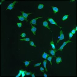 Progestin Receptor beta Polyclonal Antibody, Invitrogen 100 &mu;L; Unconjugated:Antibodies,