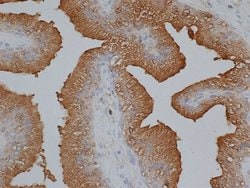 Invitrogen PSA Polyclonal Antibody 1 mL; Unconjugated:Antibodies, Polyclonal