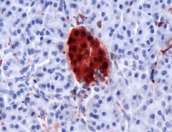 PGP9.5 Polyclonal Antibody, Invitrogen 500 &mu;L; Unconjugated:Antibodies,