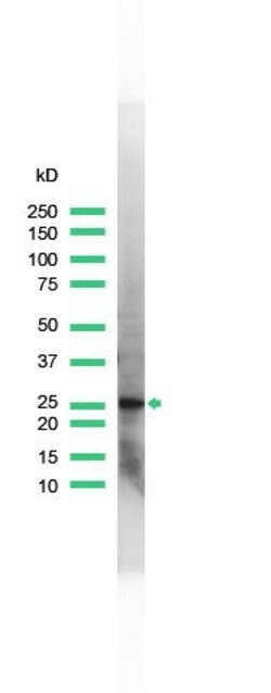 PGP9.5 Polyclonal Antibody, Invitrogen 500 &mu;L; Unconjugated:Antibodies,