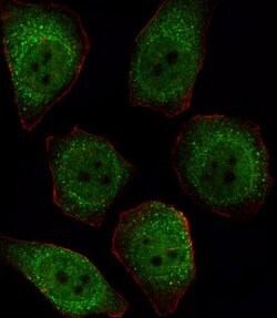 PP1 beta Rabbit anti-Human, Polyclonal, Invitrogen 400 &mu;L; Unconjugated:Antibodies,