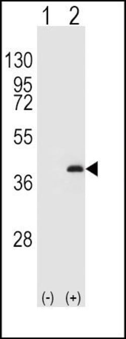 PP1 beta Rabbit anti-Human, Polyclonal, Invitrogen 400 &mu;L; Unconjugated:Antibodies,