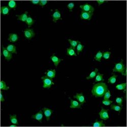 Progestin Receptor beta Polyclonal Antibody, Invitrogen 100 &mu;L; Unconjugated:Antibodies,
