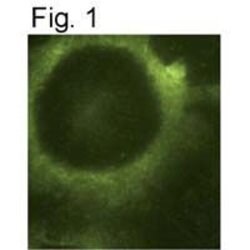 Invitrogen PSEN2 Monoclonal Antibody (APS 26) 200 &mu;g; Unconjugated:Antibodies,