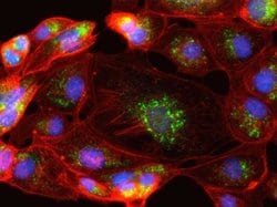 Invitrogen&trade;&nbsp;Goat anti-Rabbit IgG (H+L) Cross-Adsorbed ReadyProbes&trade; Secondary Antibody, Alexa Fluor&trade; 594