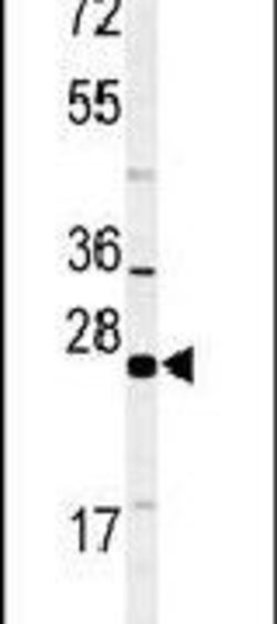 RAB27B Polyclonal Antibody, Invitrogen 400 &mu;L; Unconjugated:Antibodies,