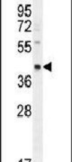 RAB3IL1 Rabbit anti-Human, Polyclonal, Invitrogen 400 &mu;L; Unconjugated:Antibodies,