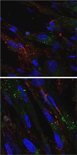 Invitrogen RAB5 Polyclonal Antibody 100 &mu;L; Unconjugated:Antibodies,